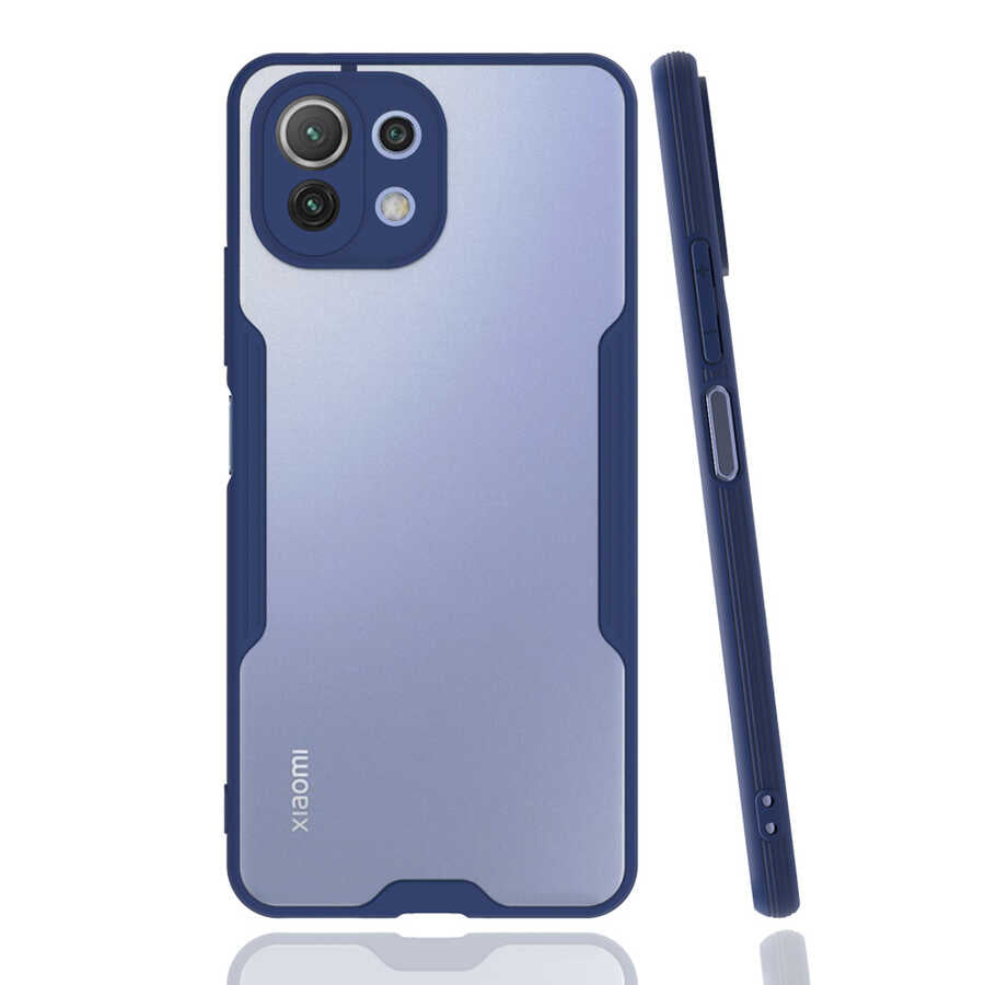 Xiaomi Mi 11 Lite Kılıf Zore Parfe Kapak