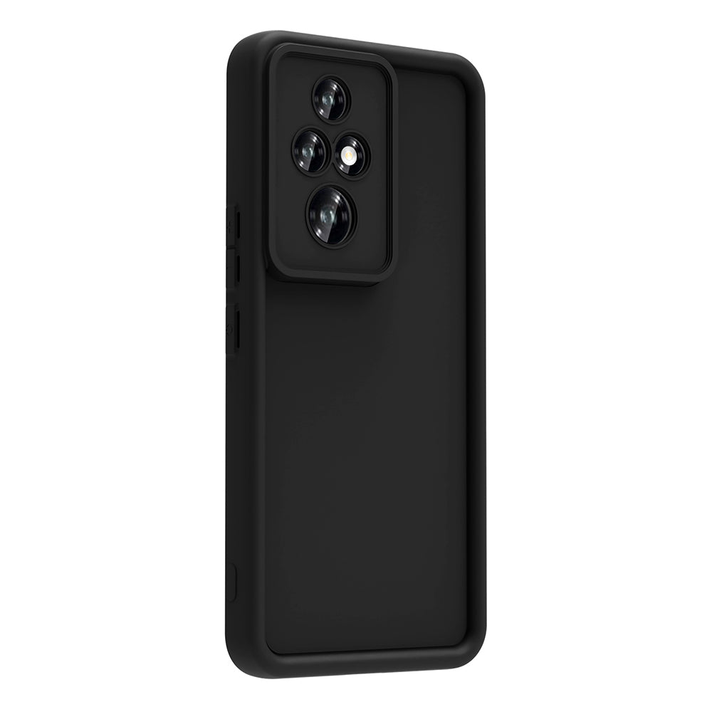 Honor 200 Pro Kılıf Kamera Korumalı Zore Ananas Kapak