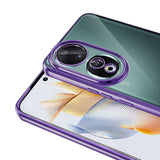 Honor 90 Kılıf Kamera Korumalı Logo Gösteren Zore Omega Kapak