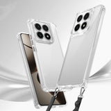 Xiaomi 14T Kılıf Airbagli Takılabilir Askı Aparatlı Zore Snap Silikon Kapak