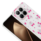 Xiaomi 15T Pro Kılıf Kamera Korumalı Desenli Zore Klip Kapak