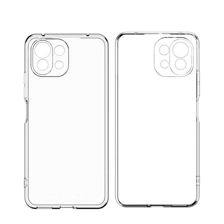 Xiaomi Mi 11 Kılıf Zore Kamera Korumalı Süper Silikon Kapak