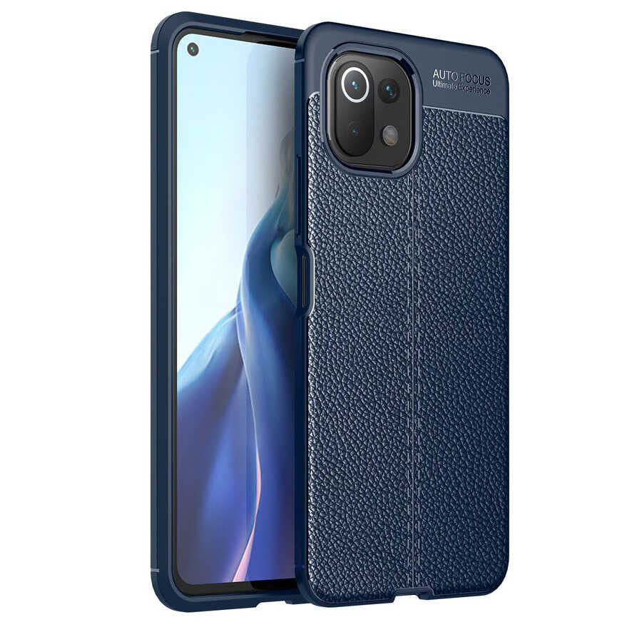 Xiaomi Mi 11 Lite Kılıf Zore Niss Silikon Kapak
