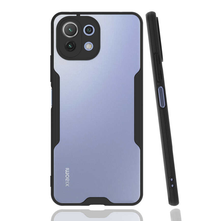 Xiaomi Mi 11 Lite Kılıf Zore Parfe Kapak
