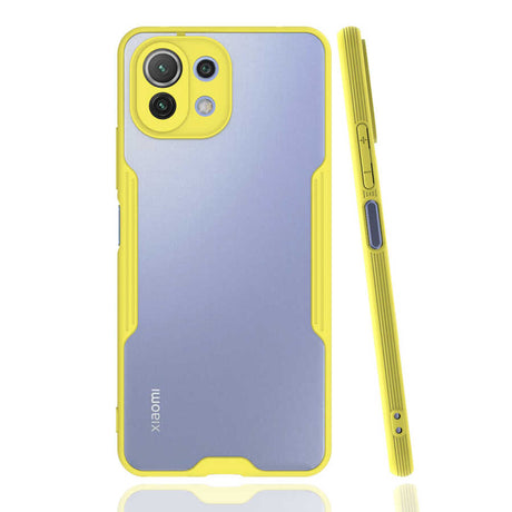 Xiaomi Mi 11 Lite Kılıf Zore Parfe Kapak