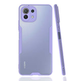 Xiaomi Mi 11 Lite Kılıf Zore Parfe Kapak