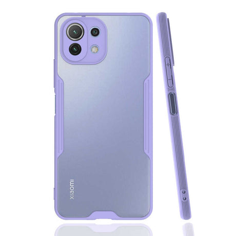 Xiaomi Mi 11 Lite Kılıf Zore Parfe Kapak