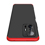 Xiaomi Mi 11T 5G Kılıf Zore Ays Kapak