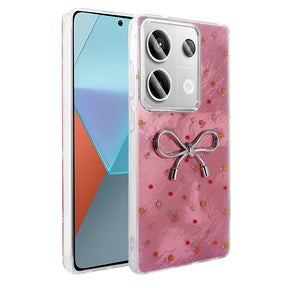 Xiaomi Redmi Note 13 Pro 4G Kılıf Kamera Korumalı Figürlü Zore Ponti Silikon Kapak