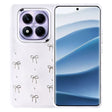 Xiaomi Redmi Note 14 Pro Plus Kılıf Airbag Tasarımlı Simli Şeffaf Zore Kutup Kapak