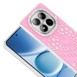 Xiaomi Redmi Note 15 Pro 4G Kılıf Damla Taşlı Zore Rivas Sert PC Kapak