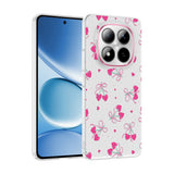 Xiaomi Redmi Note 15 Pro Plus Kılıf Kamera Korumalı Desenli Zore Klip Kapak